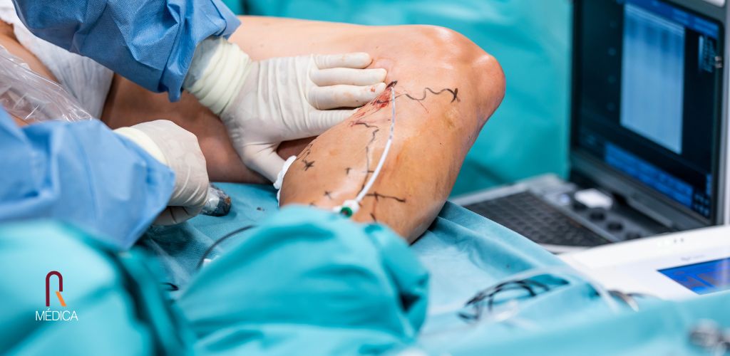 Inovação em Procedimentos Vasculares: Tecnologia, Precisão e Eficiência Hospitalar em 2026